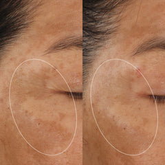 MOLECULAR HERO SERUM