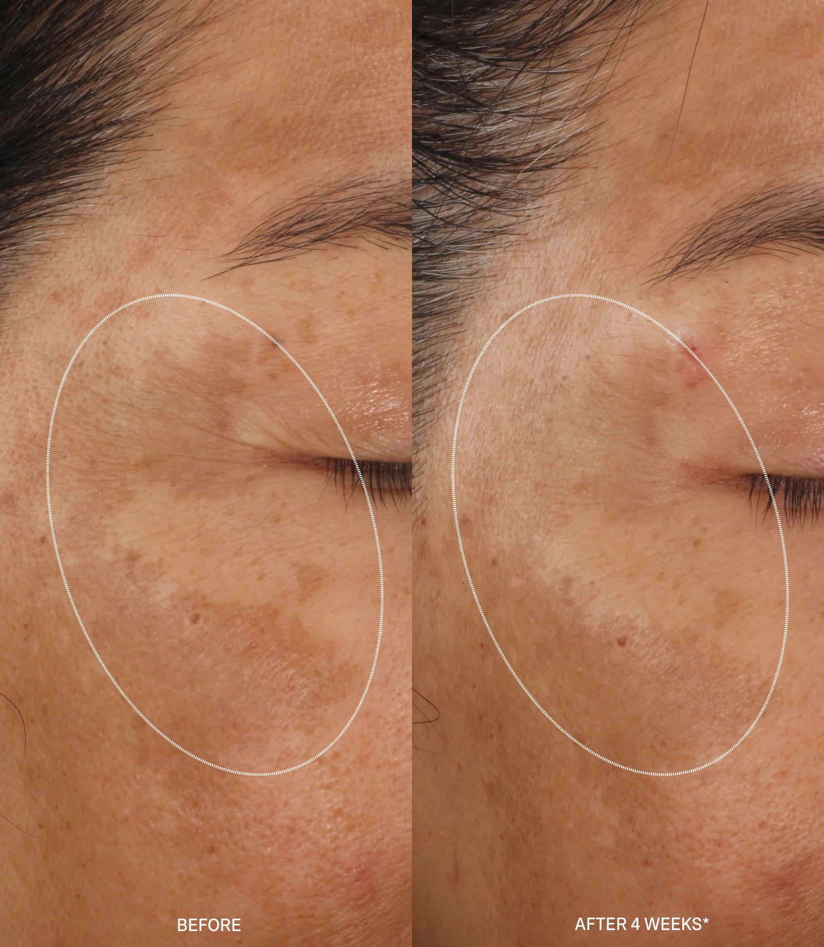 MOLECULAR HERO SERUM