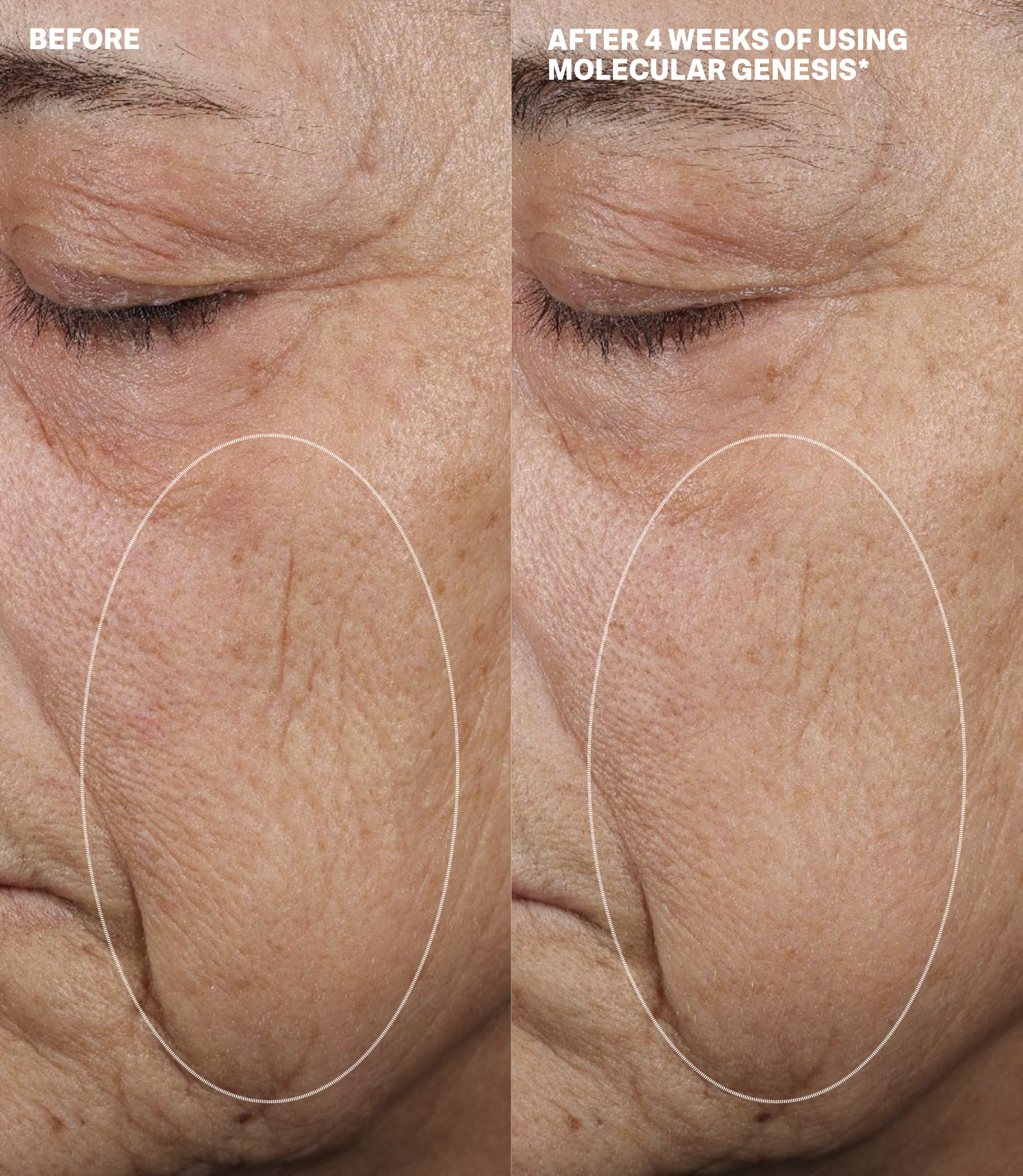 MOLECULAR DISCOVERY SET