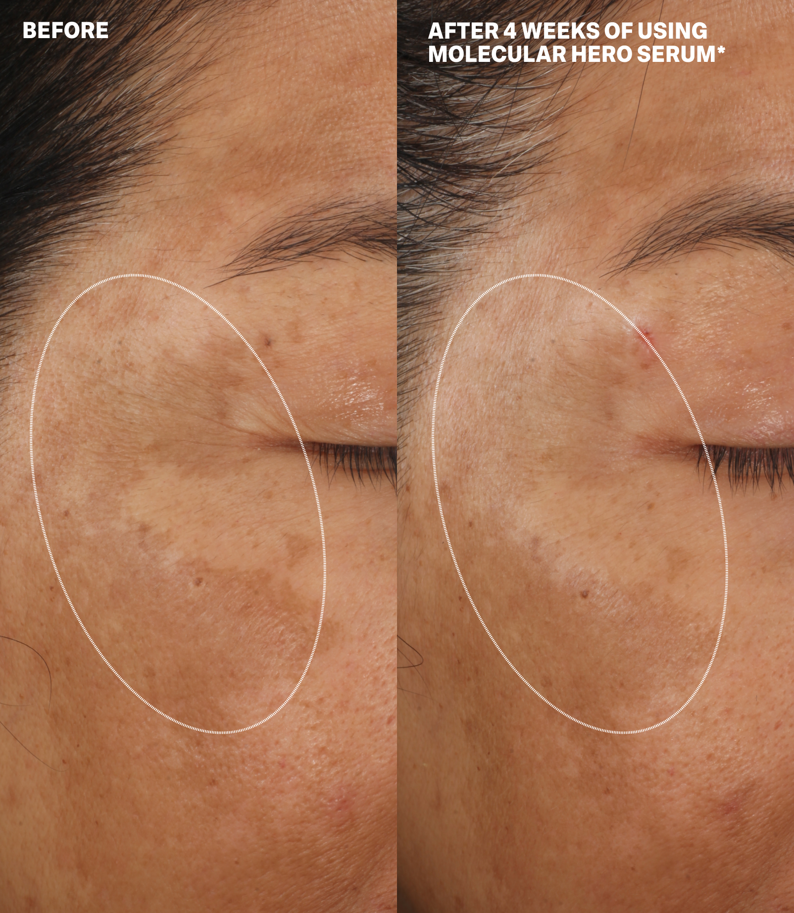 MOLECULAR DISCOVERY SET