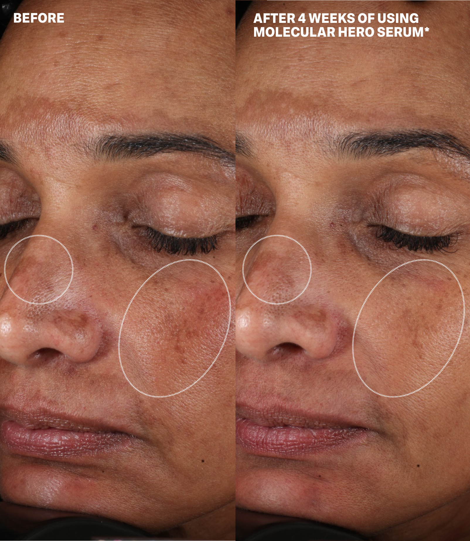 MOLECULAR DISCOVERY SET