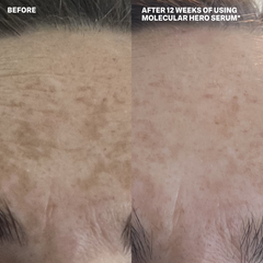 MOLECULAR DISCOVERY SET