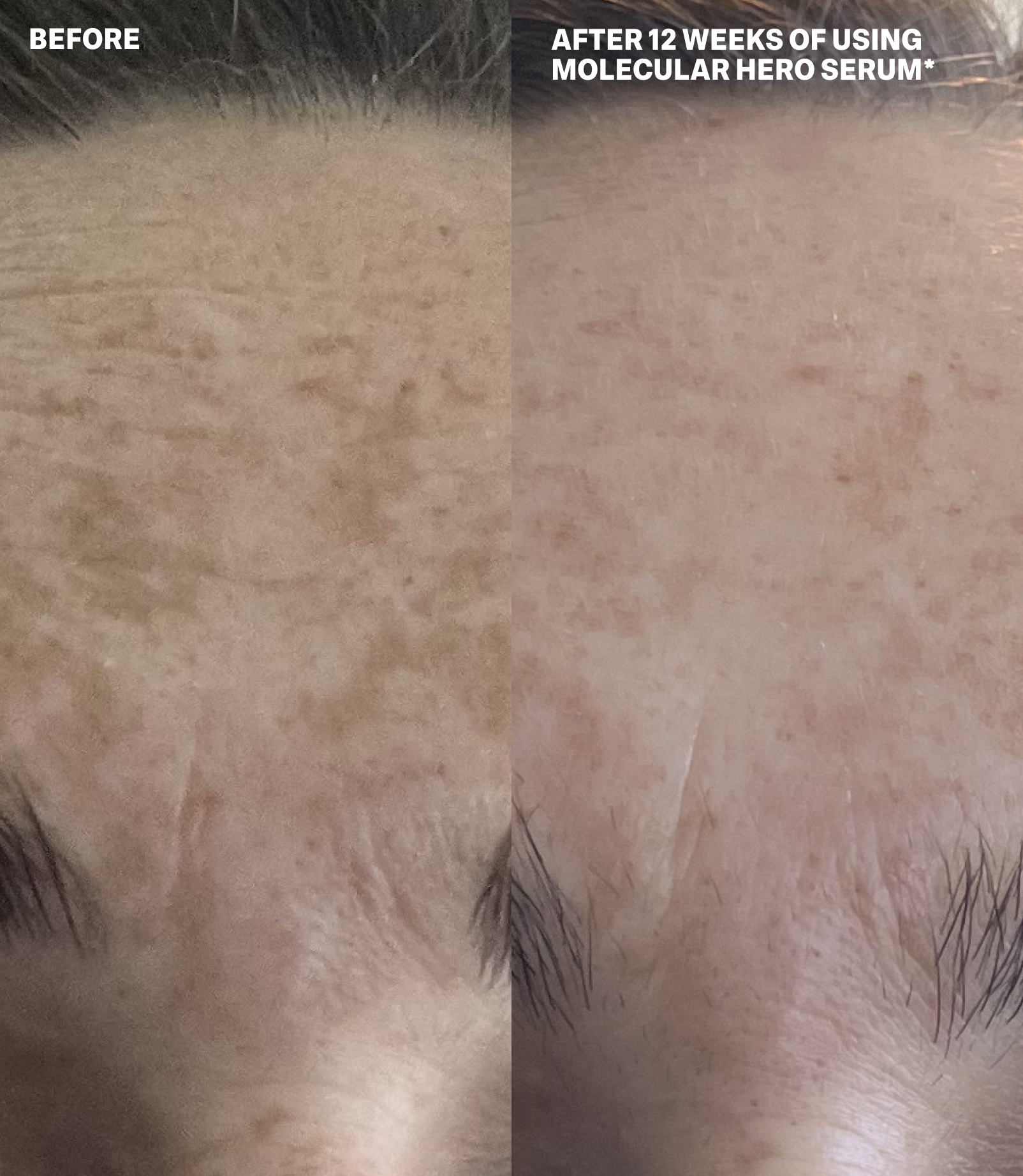 MOLECULAR DISCOVERY SET