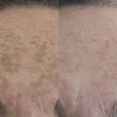 MOLECULAR HERO SERUM