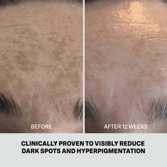 MOLECULAR HERO SERUM