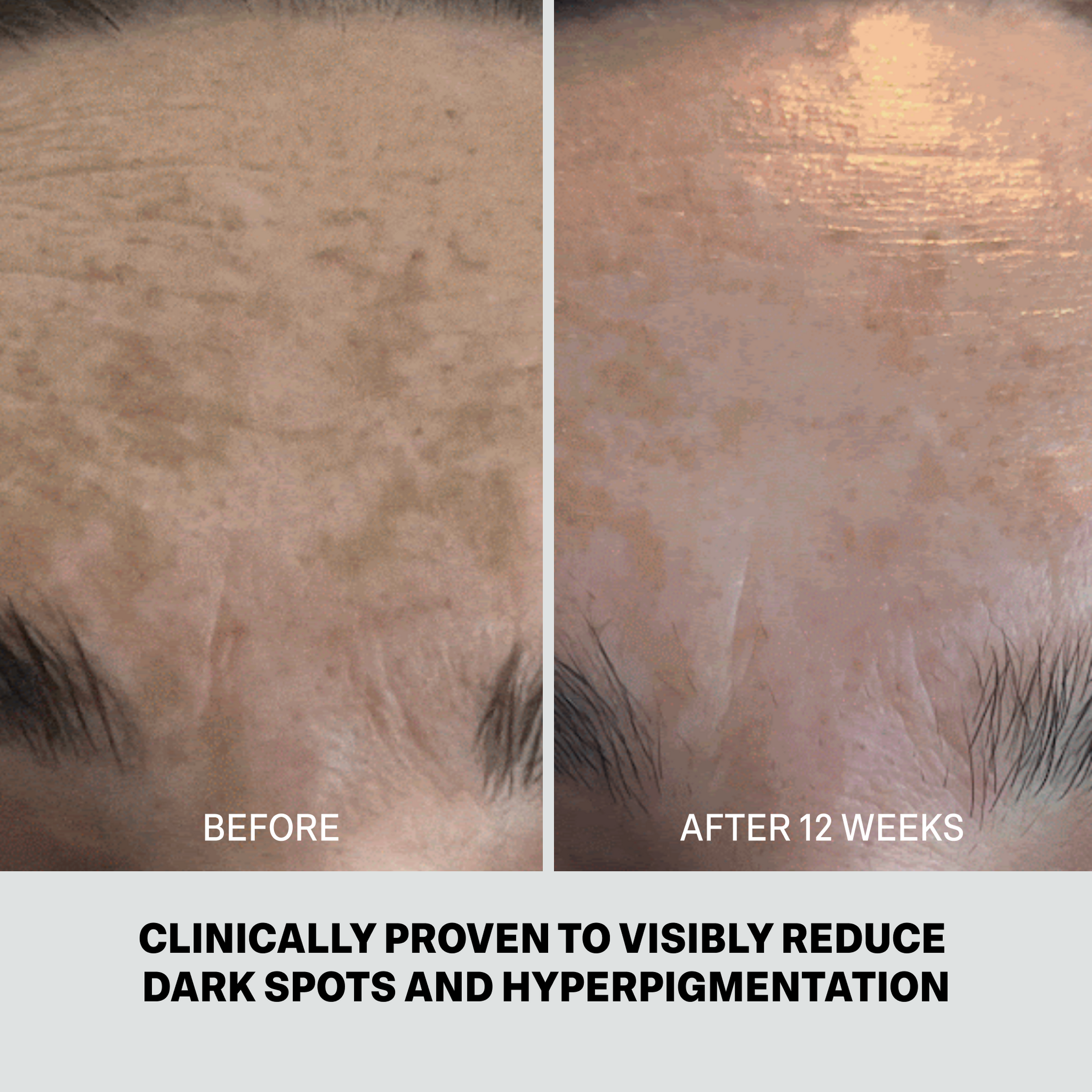 MOLECULAR HERO SERUM