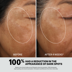 MOLECULAR HERO SERUM