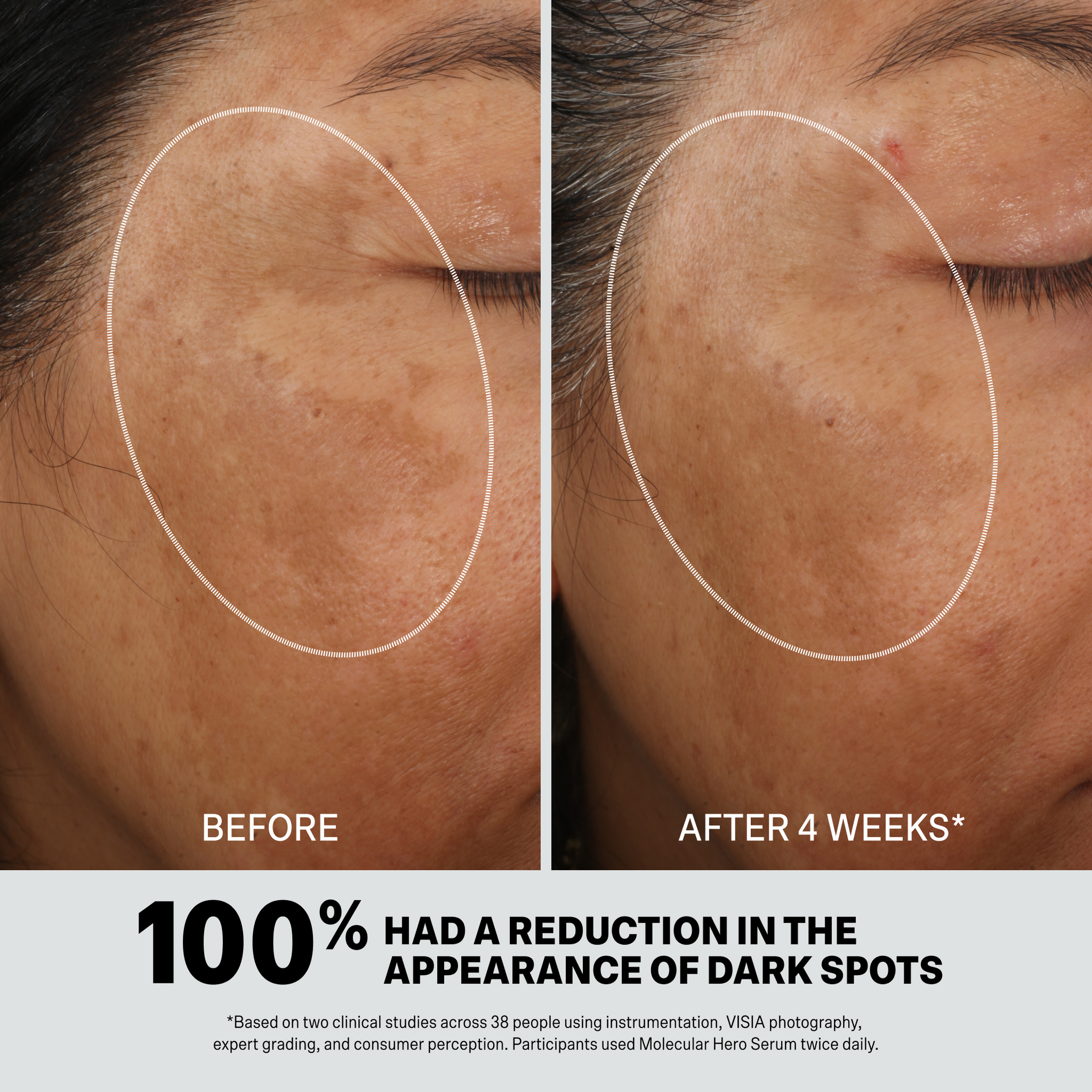 MOLECULAR HERO SERUM