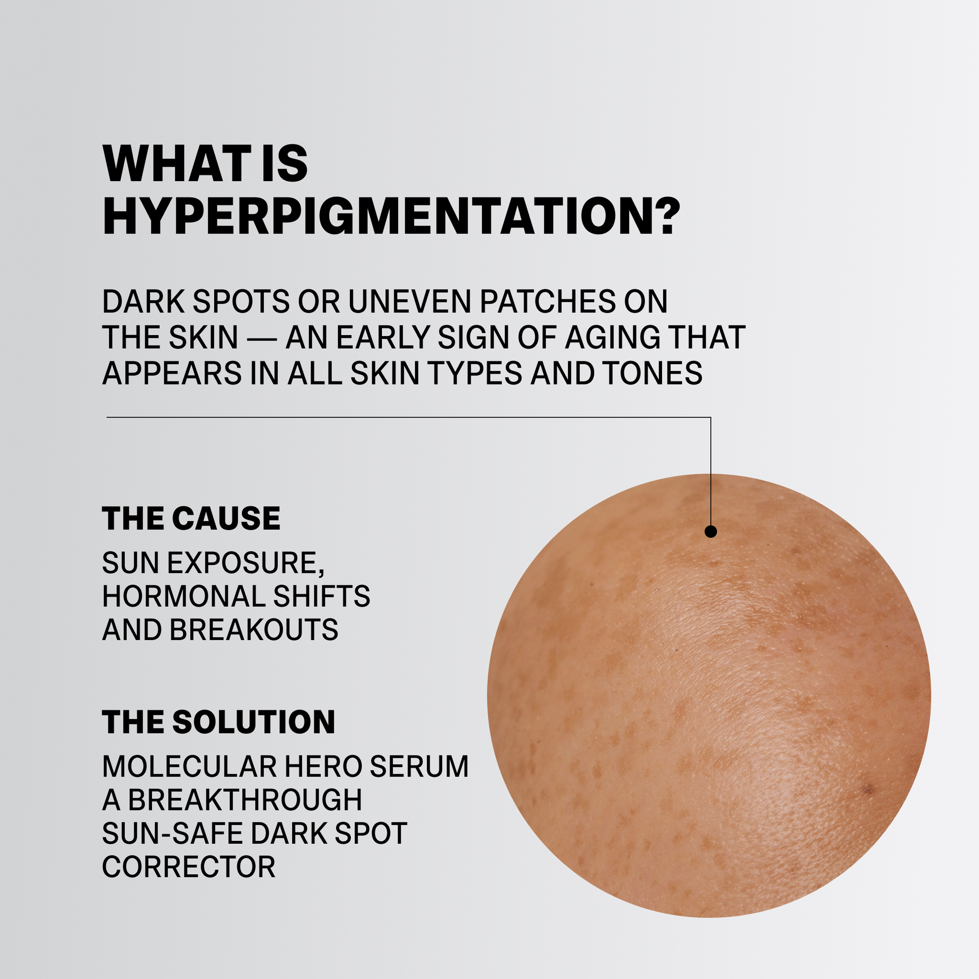MOLECULAR HERO SERUM