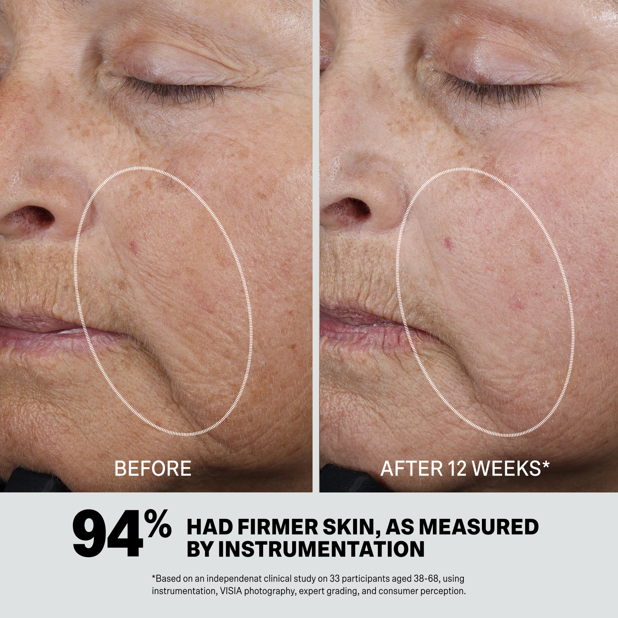 RETINOL SYNERGIST