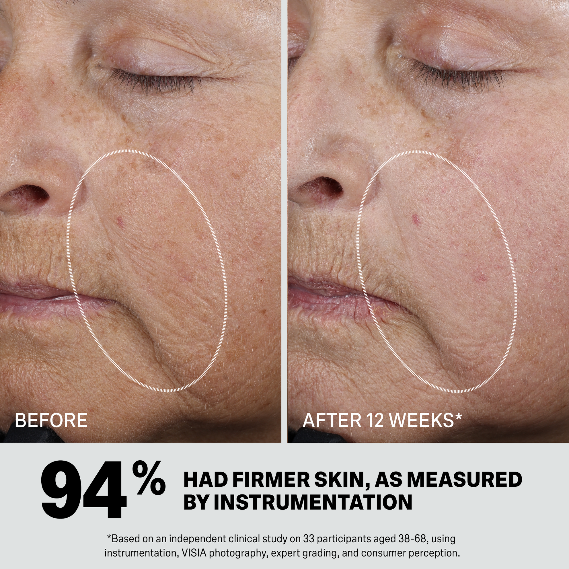 RETINOL SYNERGIST
